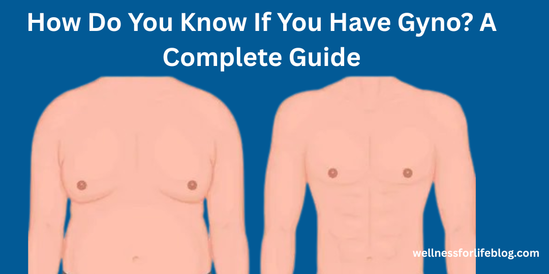 how to tell if you have gynecomastia