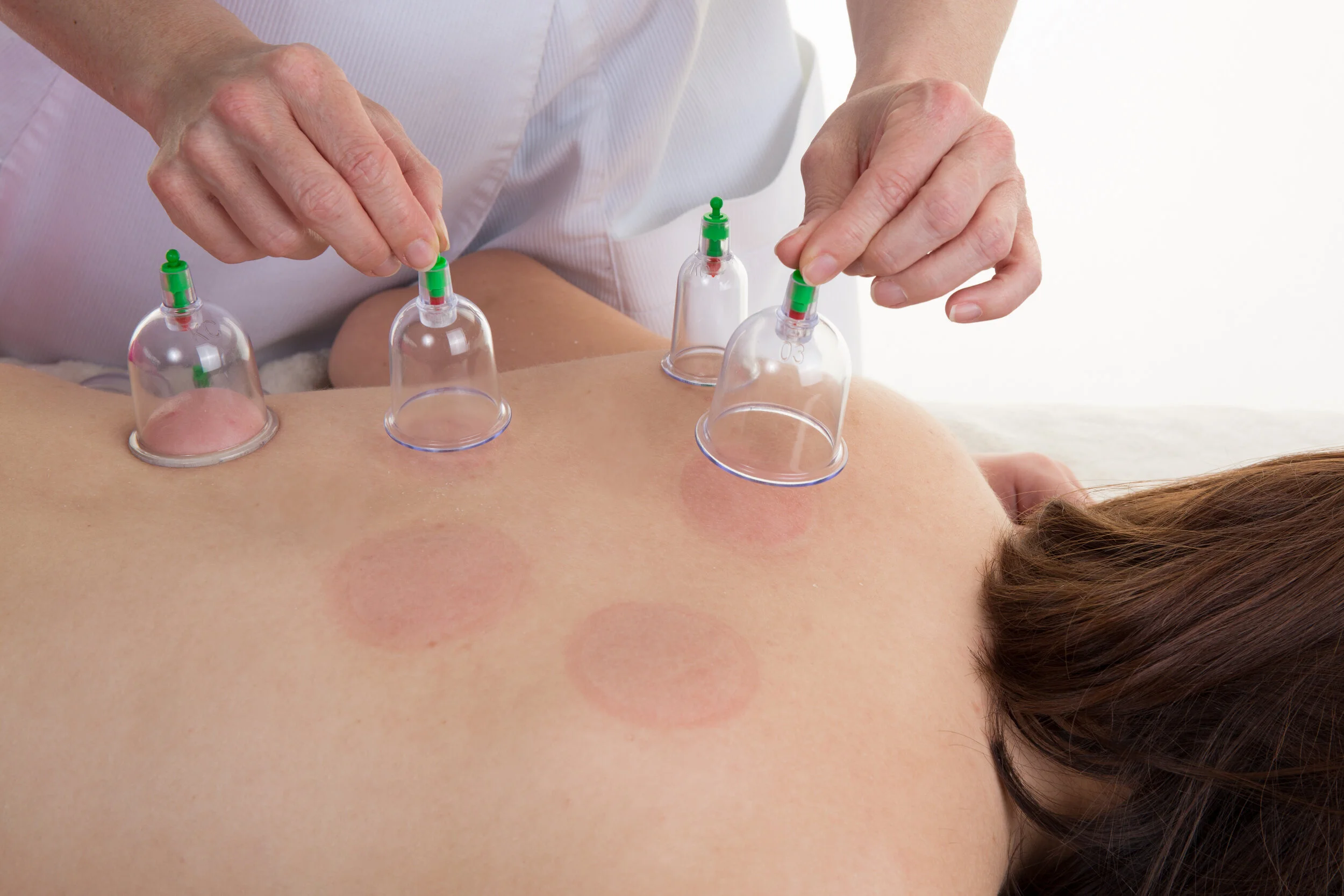 Cupping Massage Near You